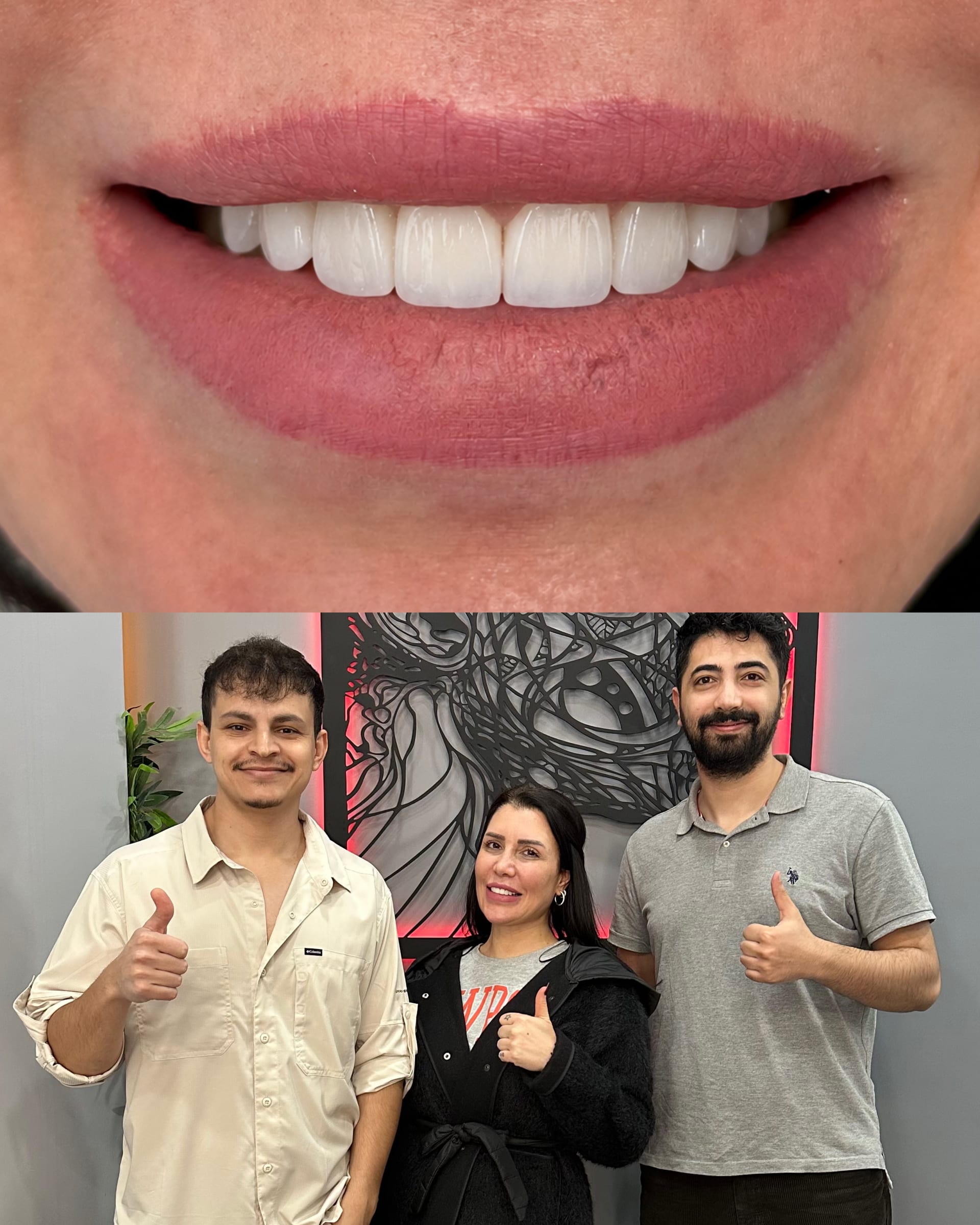 Hollywood Smile