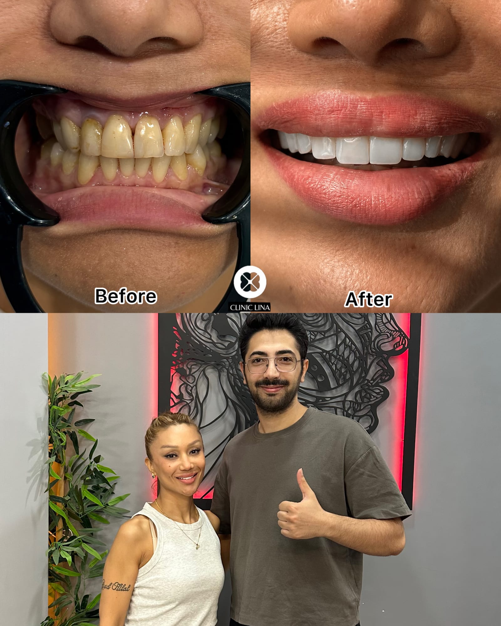 Öncesi